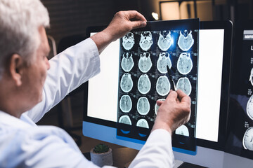 doctor with concussion brain scans